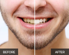 General and Cosmetic dentist in Dubai